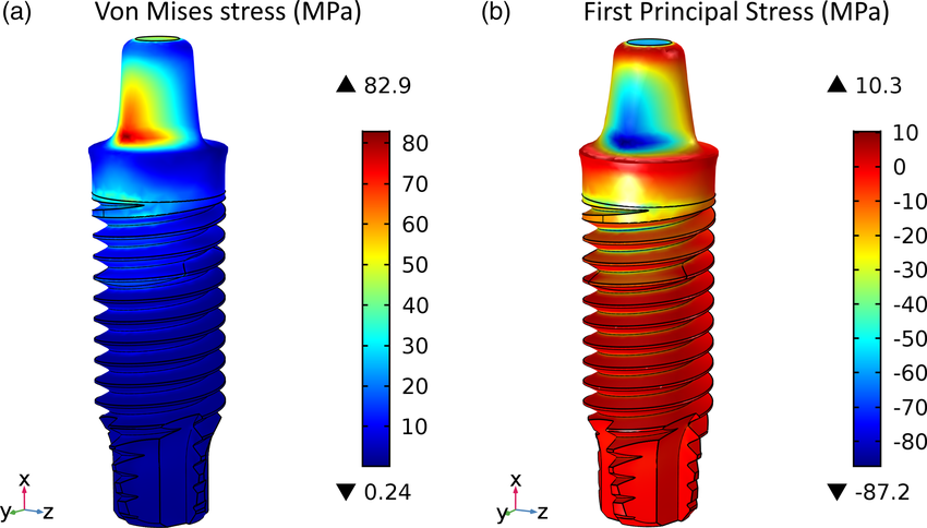 Von Mises stress plot from an FEA model